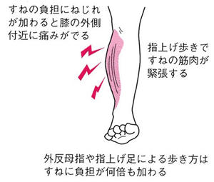 すねのはりや痛み 笠原巖の 足の痛み 専門サイト